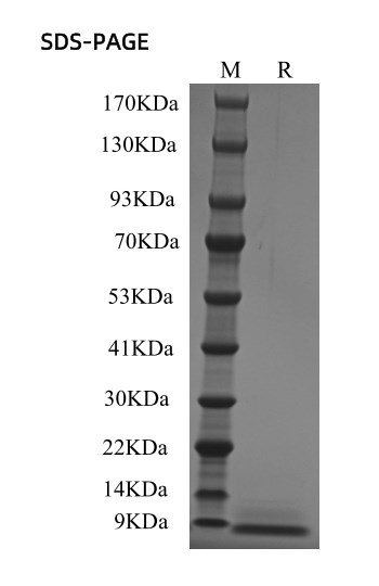 SDS-PAGE