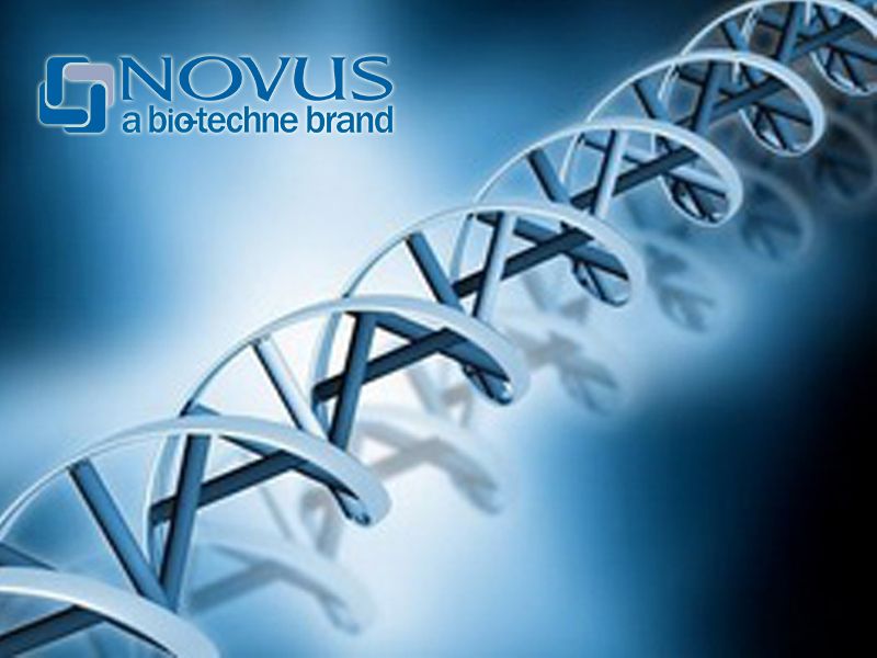 Read more about the article Novus凋亡研究系列3：死亡受体信号通路